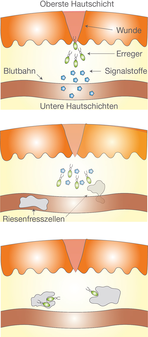 Immunsystem verstehen Abwehrmechanismen gegen Krankheitserreger
