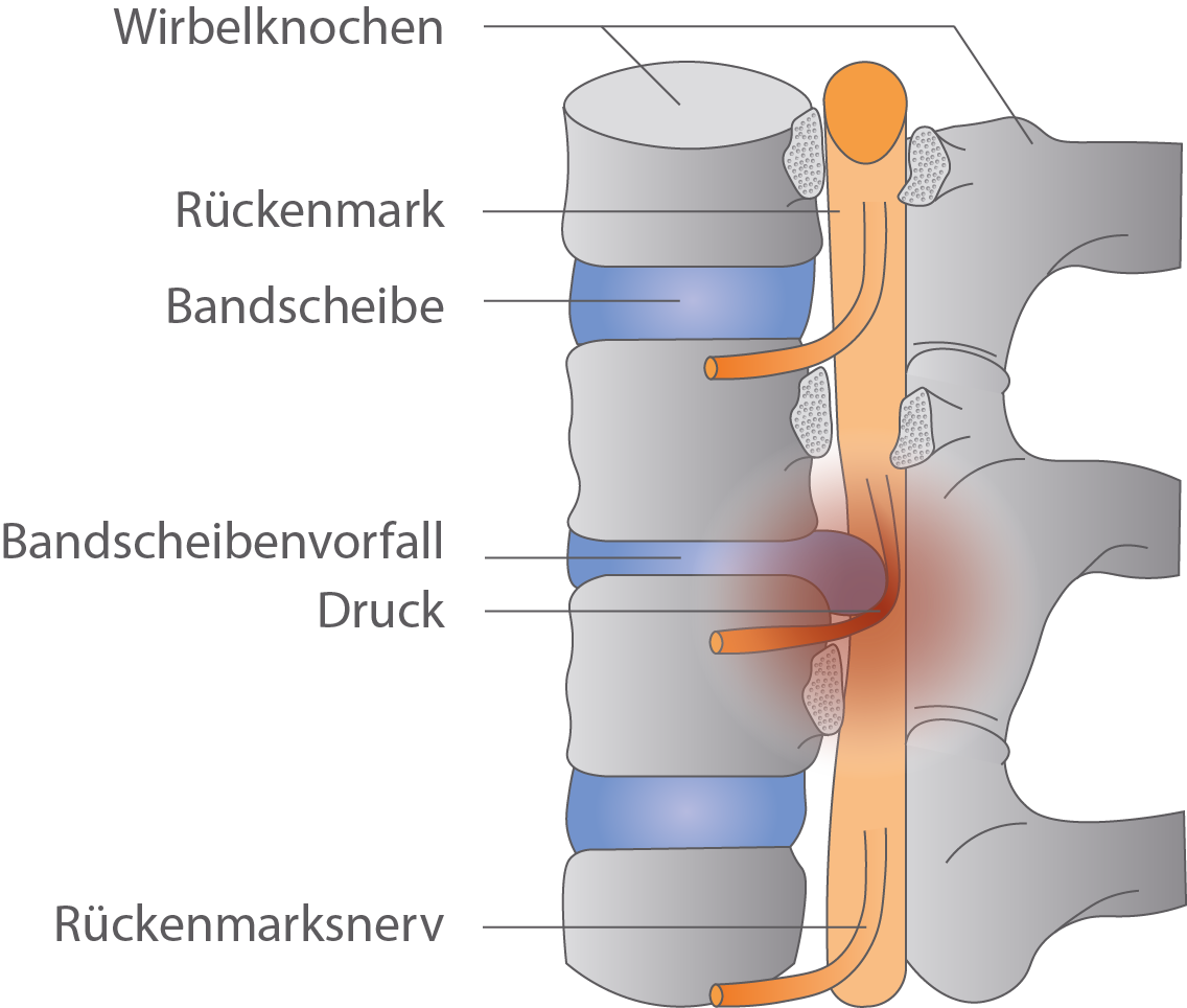 Rückenmark Nervensystem Bio Digitales Schulbuch Skripte SchulLV.de Rückenmark Nervensystem Bio Digitales Schulbuch Skripte SchulLV.de