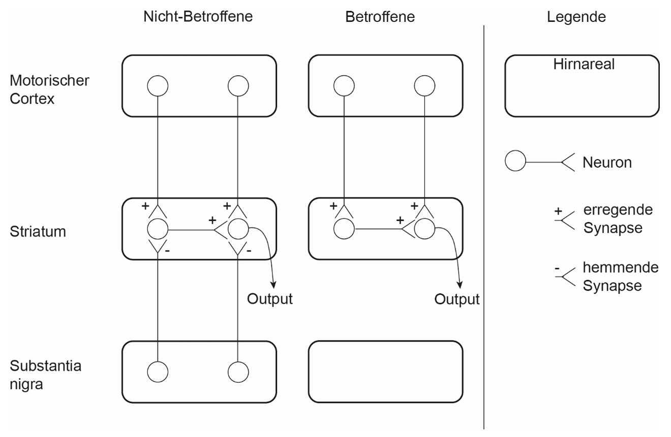 Schematische Gegenüberstellung von Motorcortex, Striatum und Substantia nigra mit erregenden/hemmenden Synapsen bei Nicht-Betroffenen vs Betroffenen.