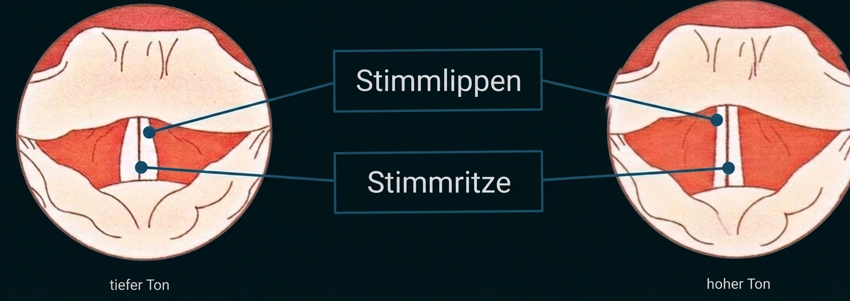 Zwei schematische Ansichten der Stimmlippen und Stimmritze beim tiefen und hohen Ton