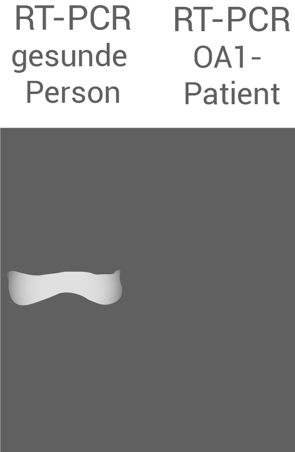 gelelektrophorese