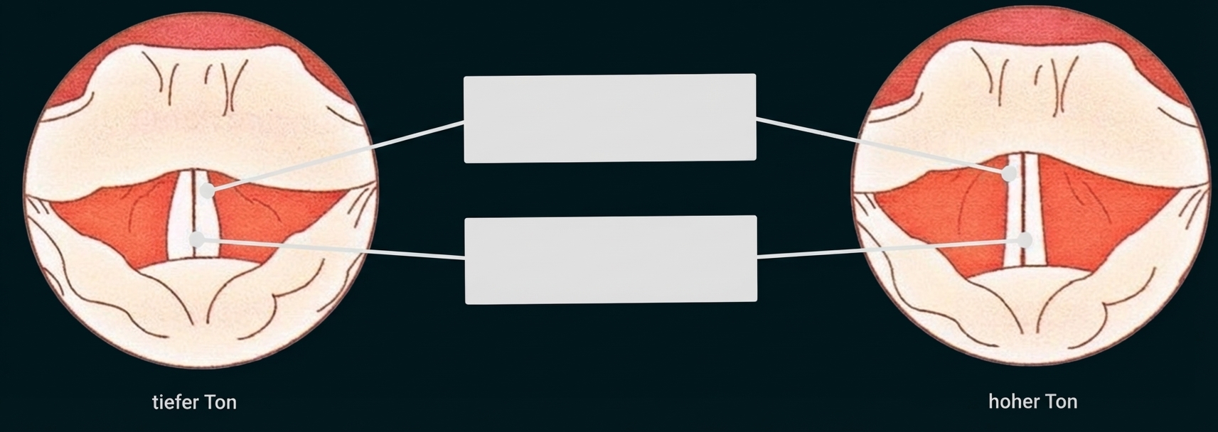 Zwei schematische Stimmbanddarstellungen: links tiefer Ton, rechts hoher Ton, markierte Stellen.