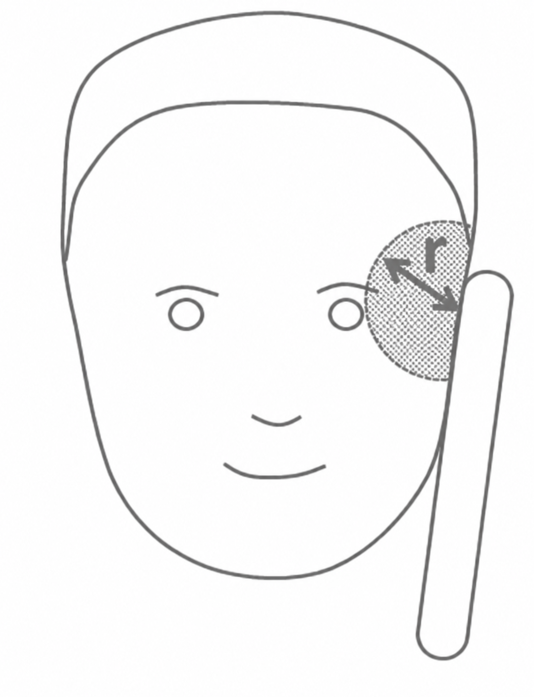 Strichzeichnung eines Gesichts mit markiertem Kreis an rechter Wange und zwei Pfeilen, daneben ein länglicher Stab.