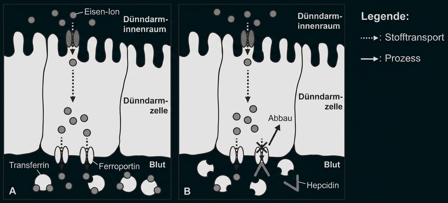 Schematische Darstellung: Eisenaufnahme im Dünndarm durch Enterozyten, Ferroportin-Export und Hepcidin-gesteuerte Blockade.