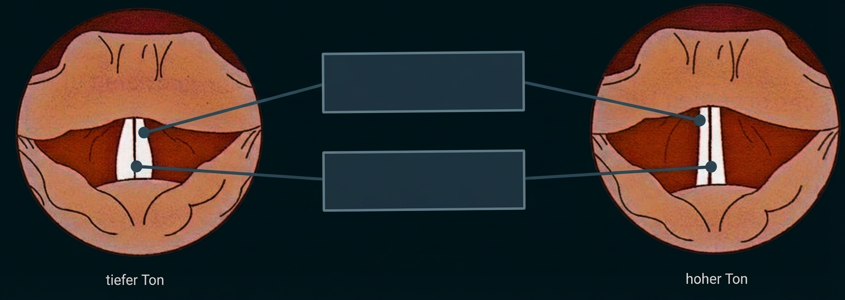 Zwei schematische Stimmlippen: links für tiefen Ton, rechts für hohen Ton