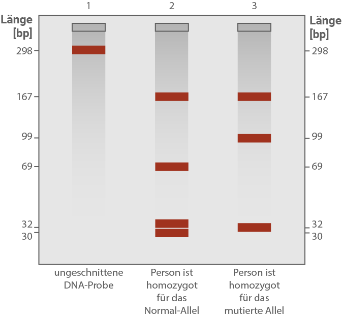 Schematische Gelelektrophorese mit drei Proben: ungeschnittene DNA, homozygot normal, homozygot mutiert, sichtbare Banden bei verschiedenen Längen
